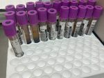 Suspensión de servicio de laboratorio en Issste pone en entredicho negociación del SNTE